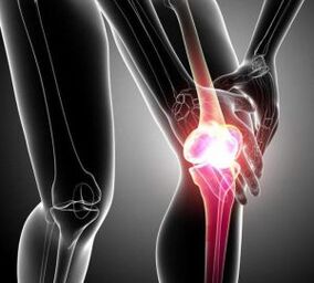 Knee pain caused by arthritis and joint disease