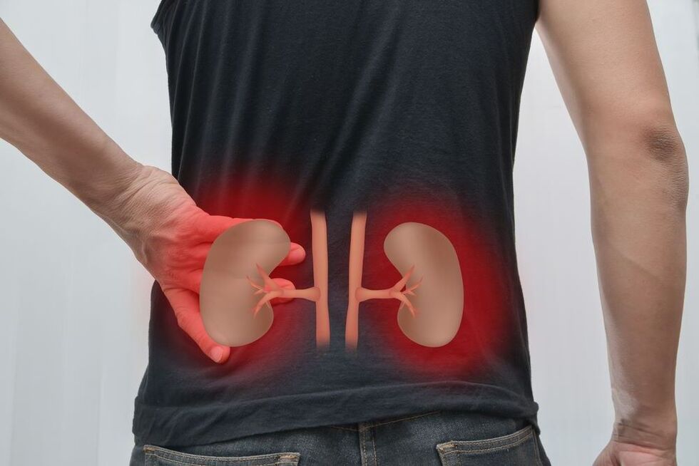 Kidney inflammation is the cause of back pain