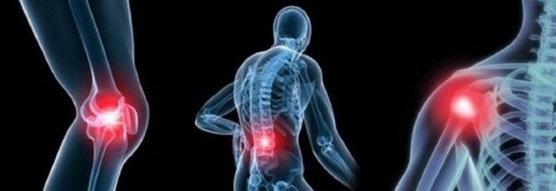 Types of pain in arthritis