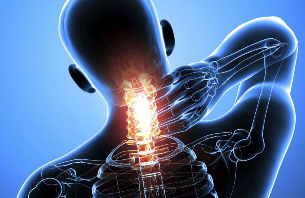 cervical osteochondrosis