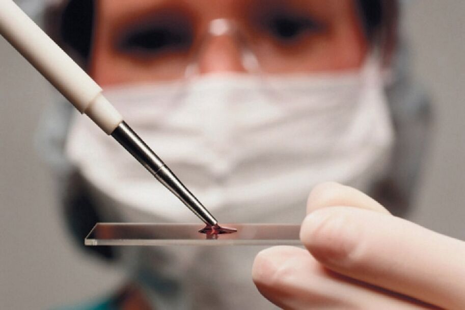 Arthritis is an inflammatory disease that can be detected with a blood test.