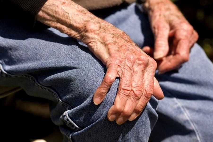 Arthropathy is an age-related disease that occurs in older adults